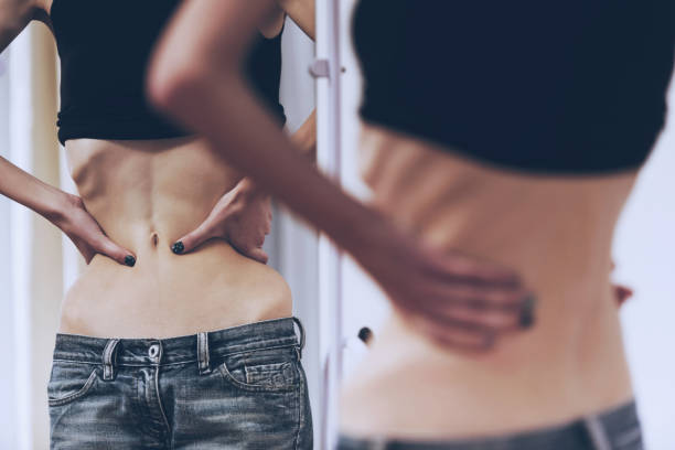 Anorexia Nervosa