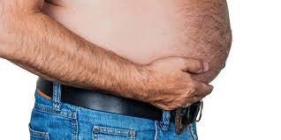 Ascites