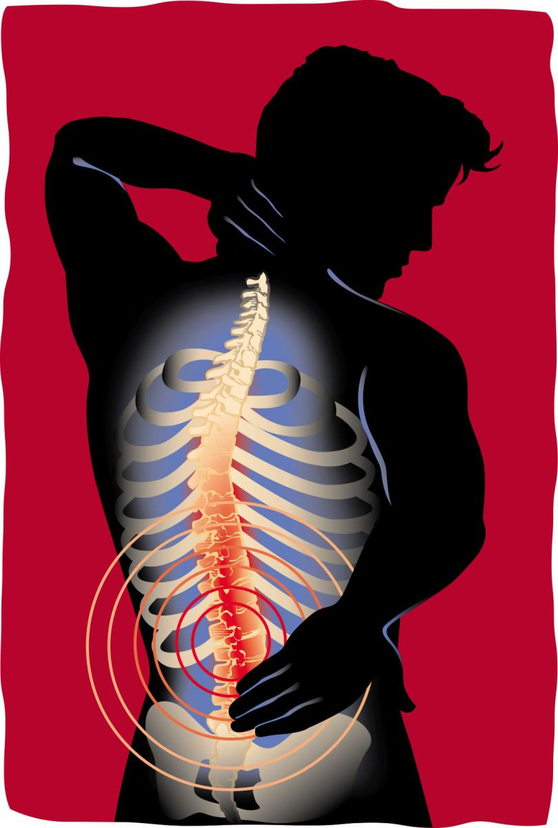 Back pain