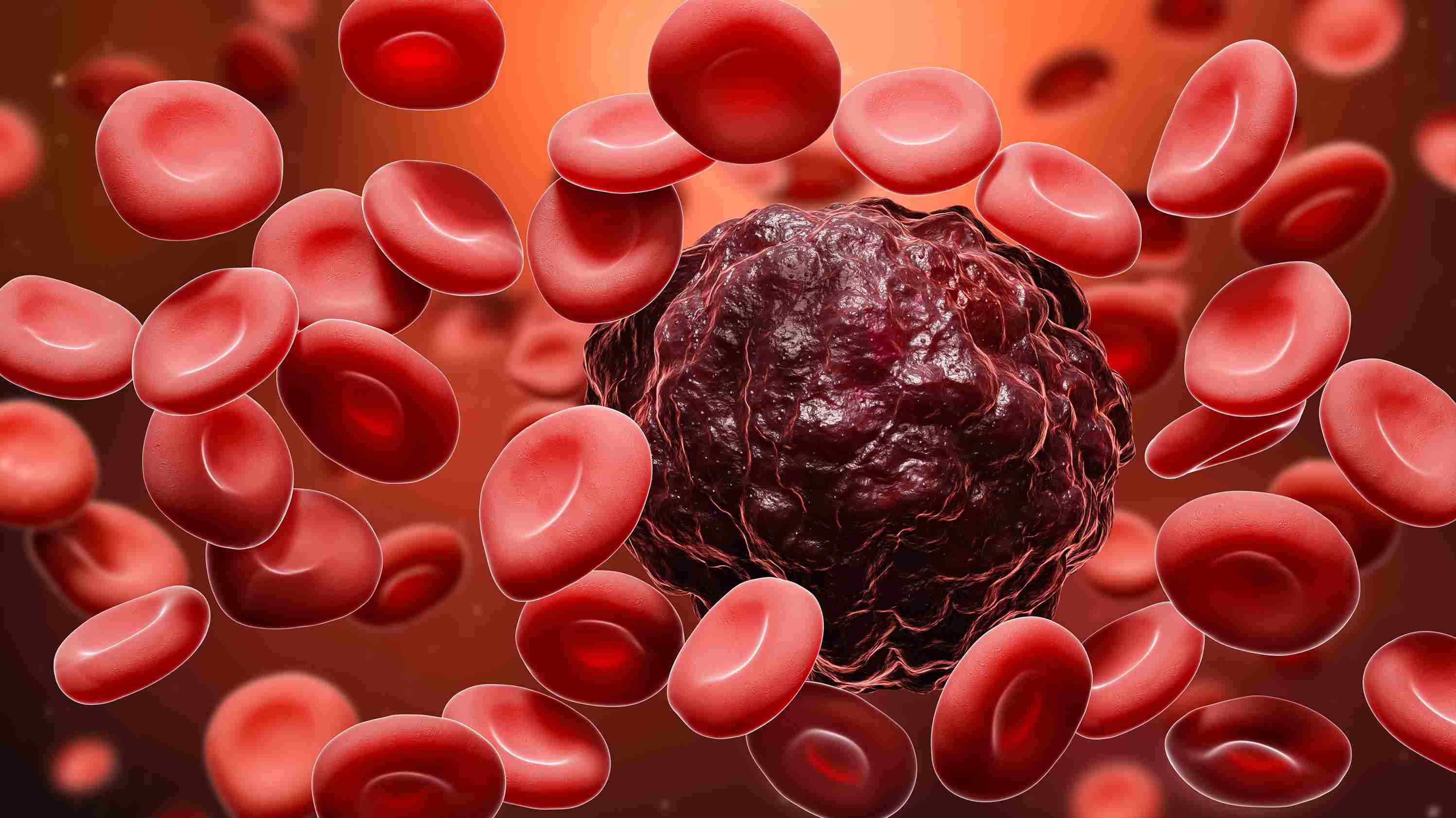Blood cancer