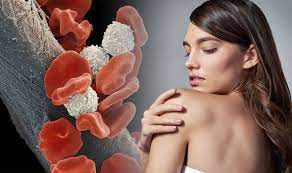 Blood cancer
