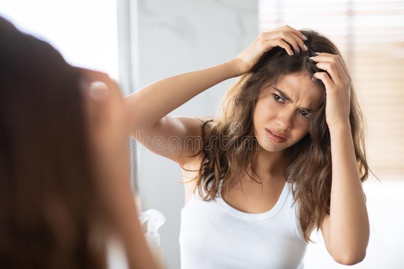 Dandruff