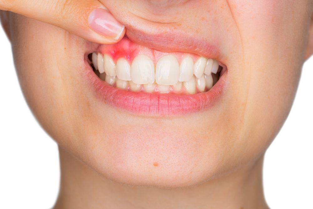 Dental pain