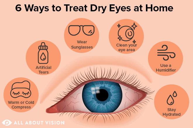 Dry eyes