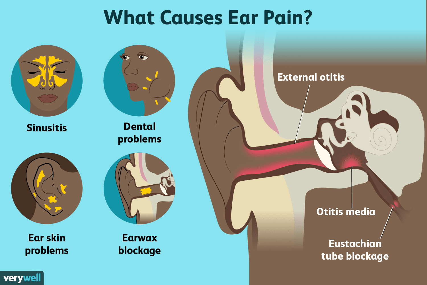 Ear pain