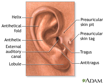 Ear pain