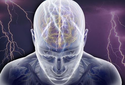 Epilepsy