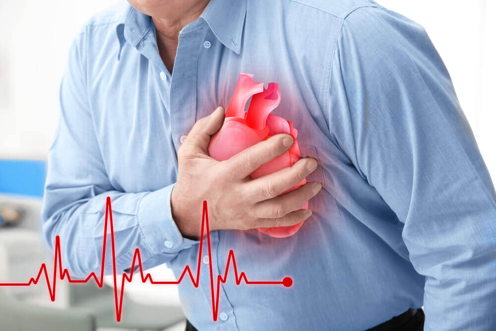 Heart attack