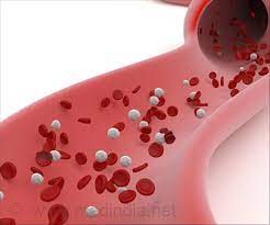 Hypercalcemia