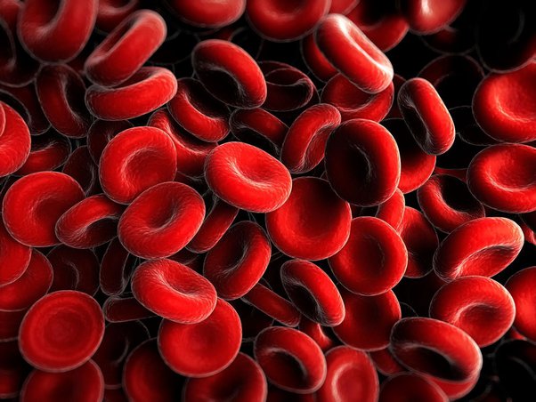 Hypercalcemia