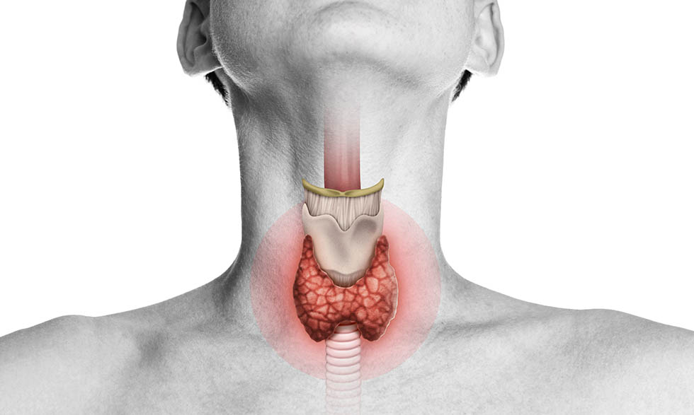 Hypothyroidism