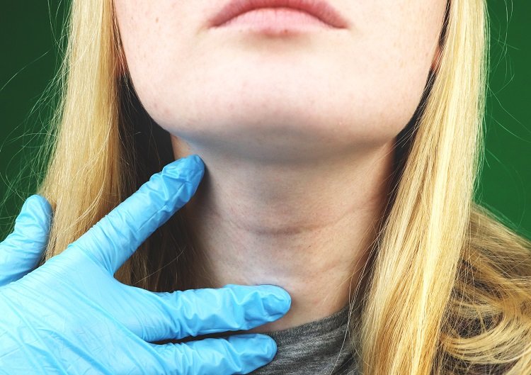 Hypothyroidism