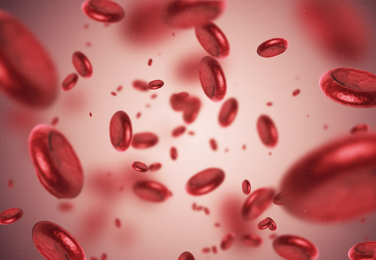 Iron deficiency anemia
