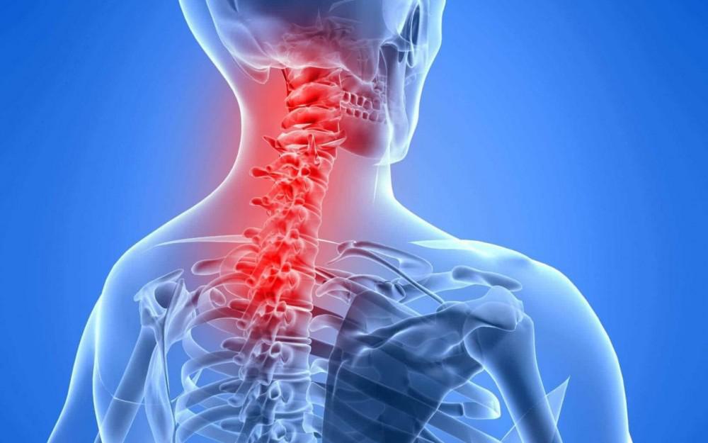 Neck pain
