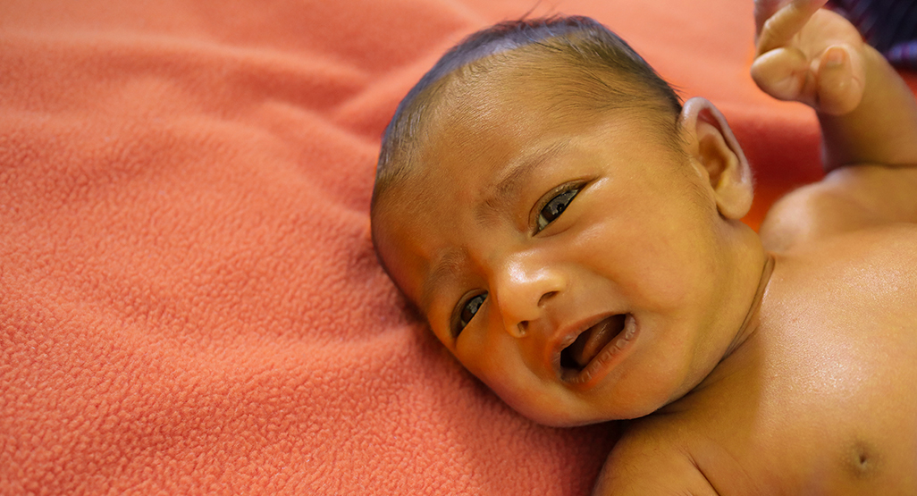 Neonatal Jaundice