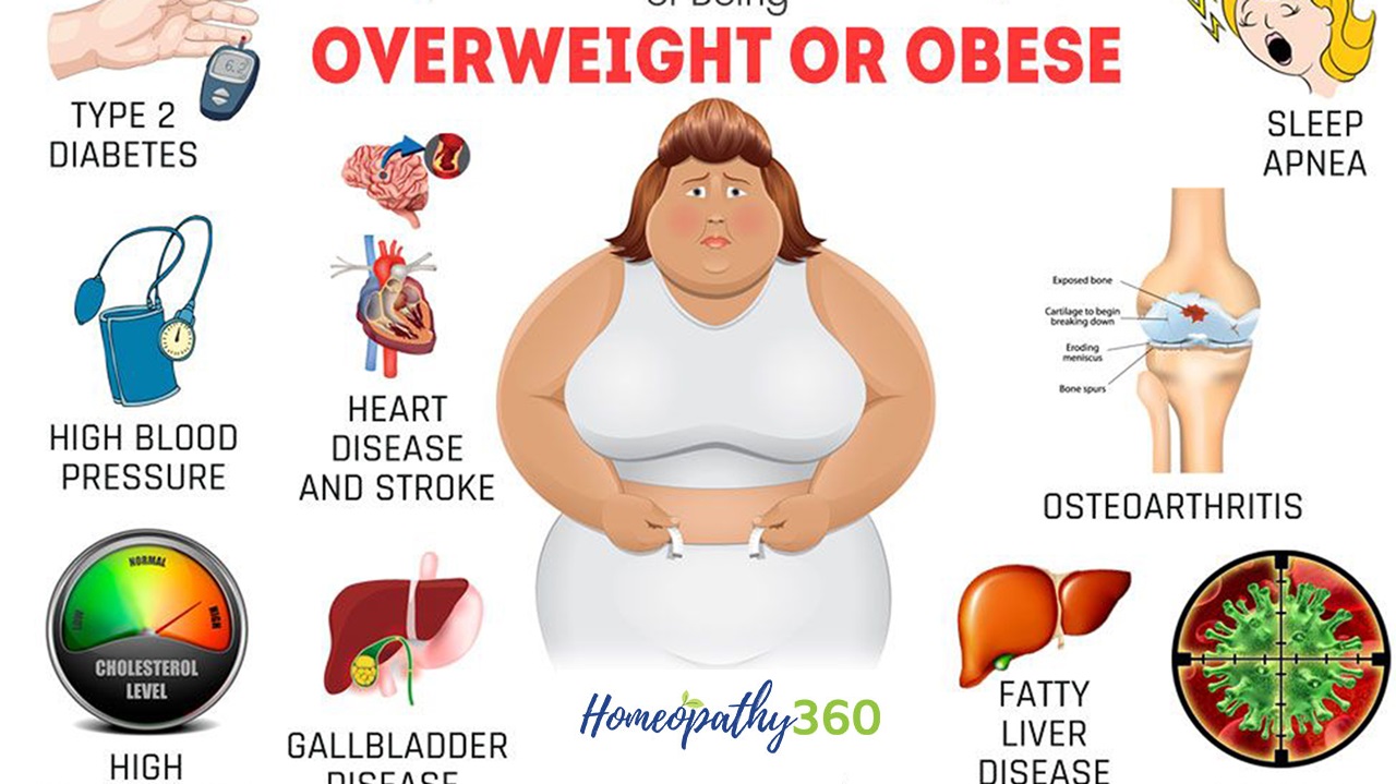 Obesity