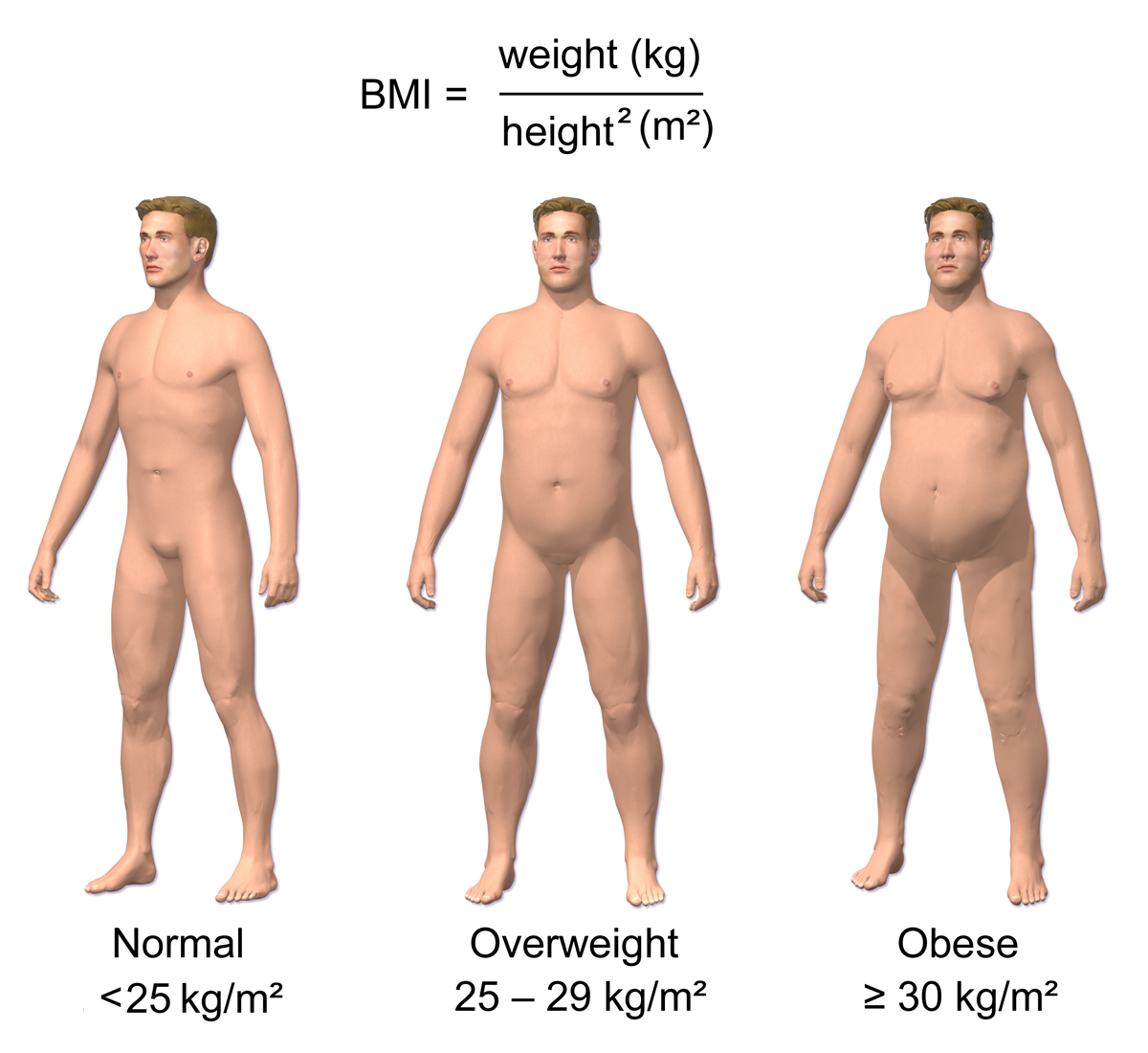 Obesity