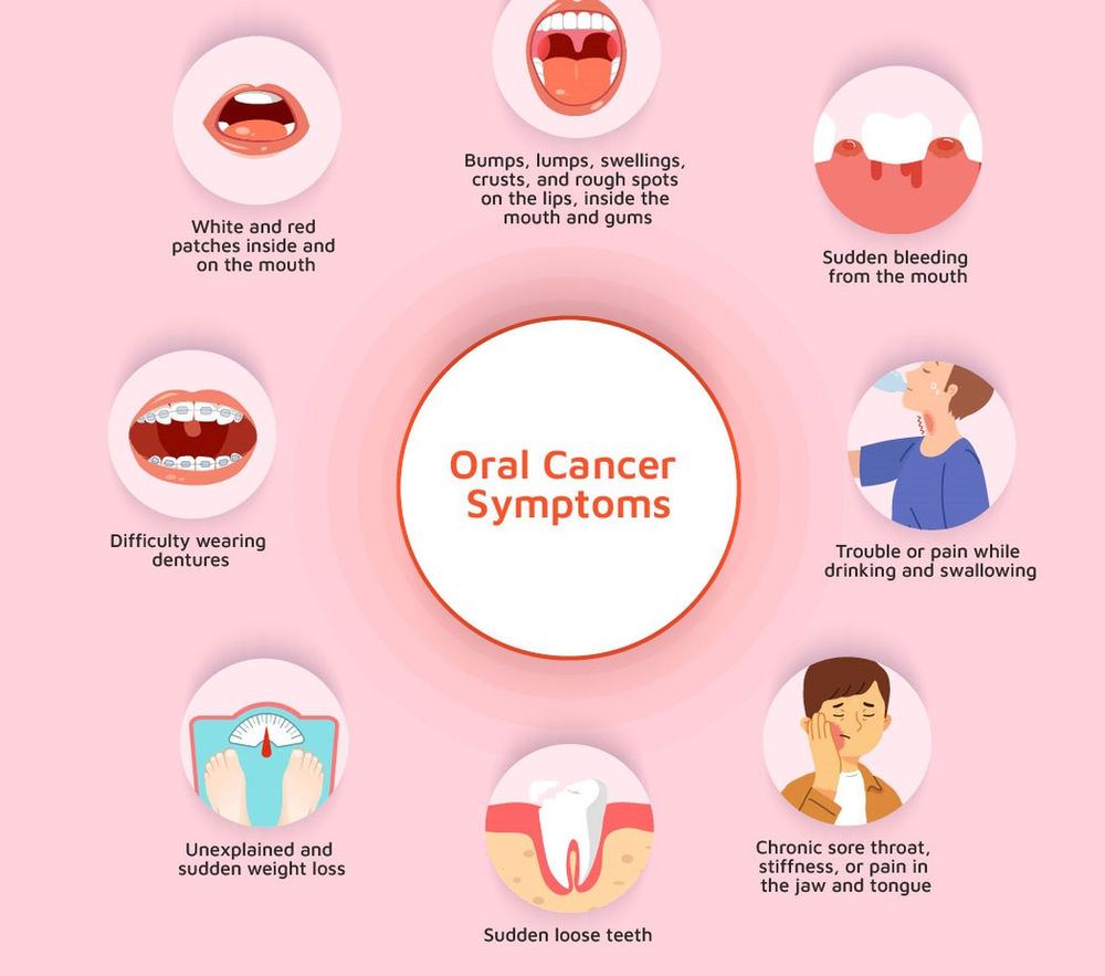 Oral cancer