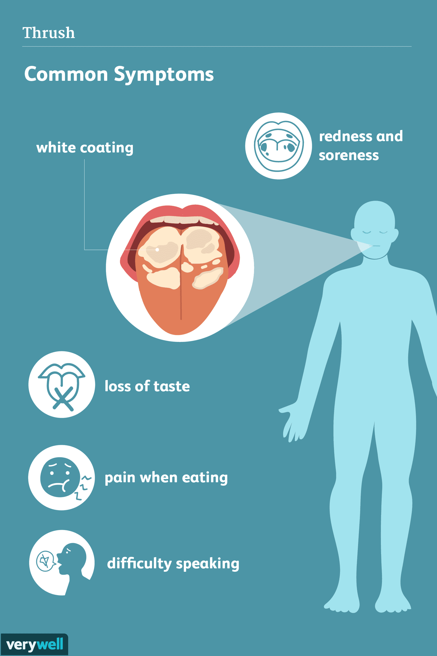 Oral thrush