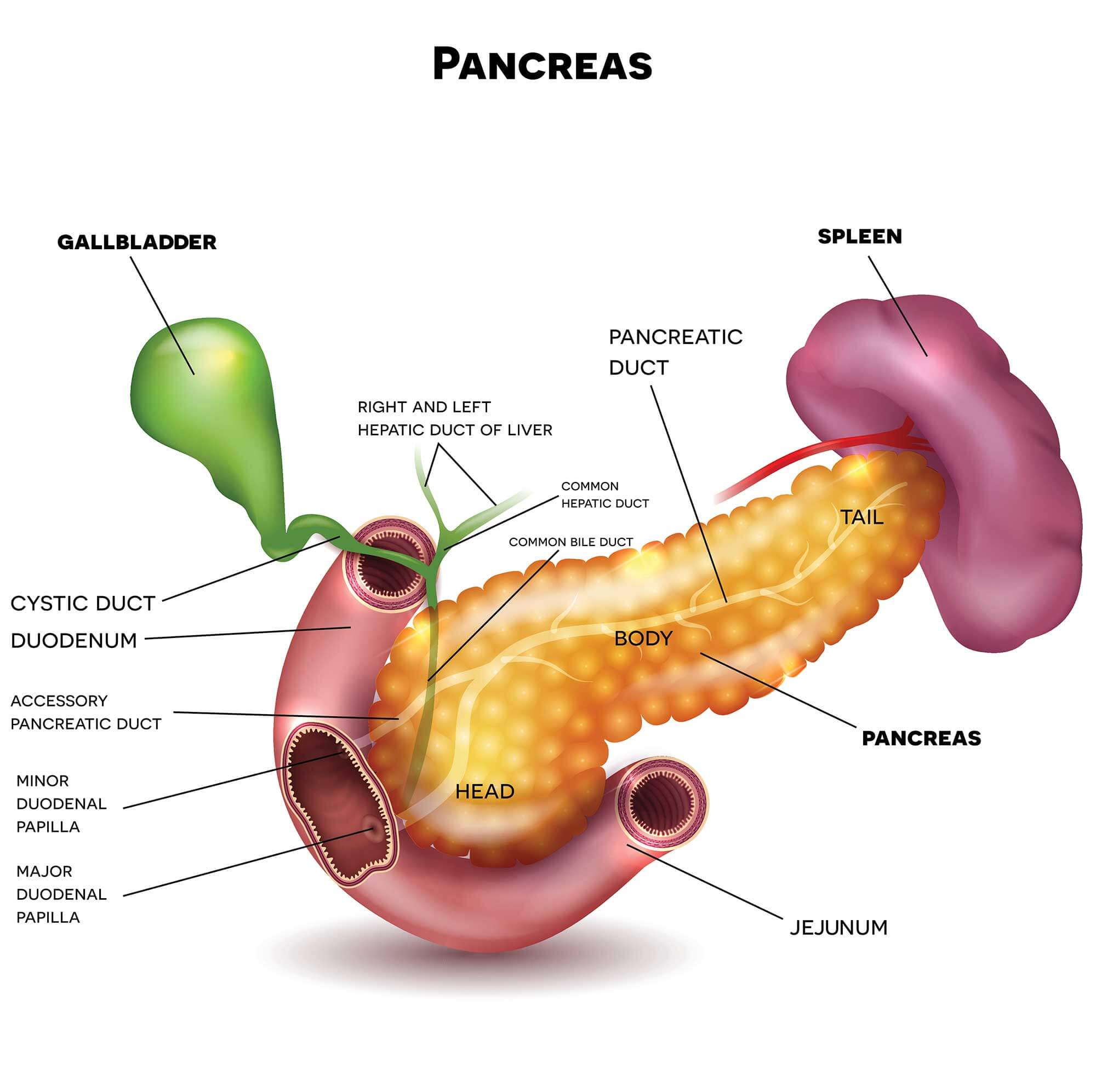 Pancreatic cancer