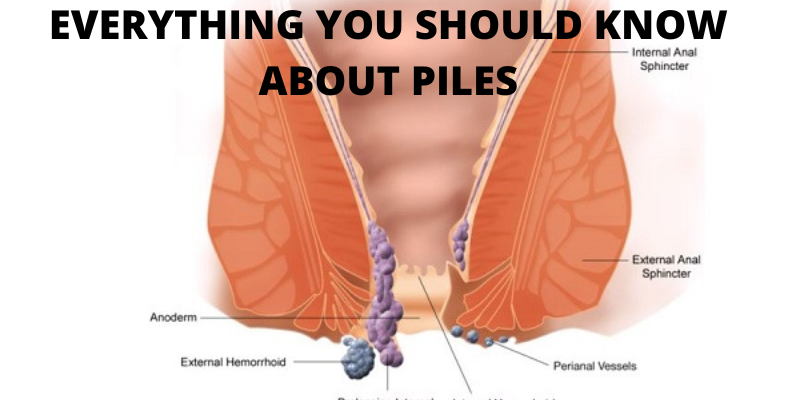 Piles