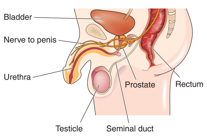 Prostatitis
