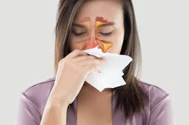 Sinusitis