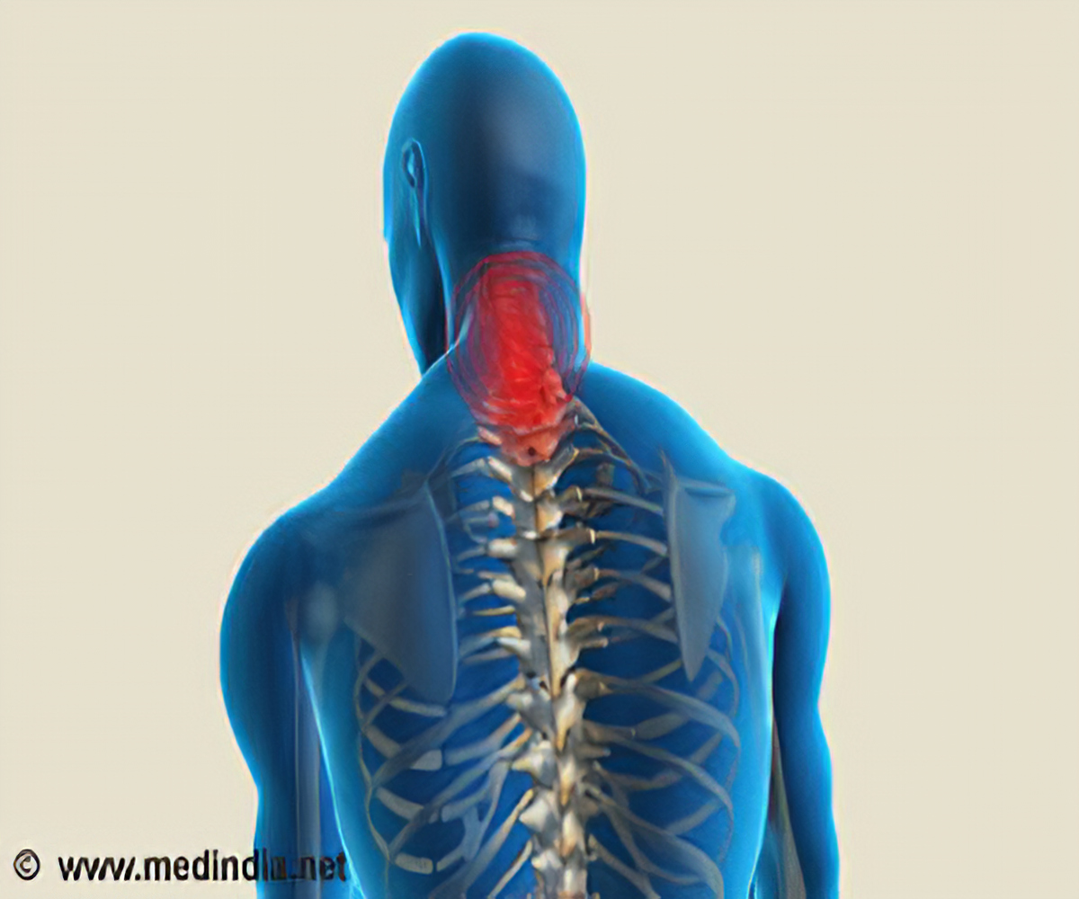Spondylosis