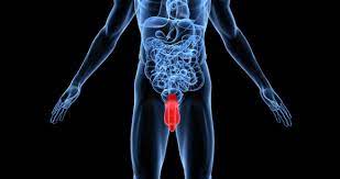 Testicular cancer