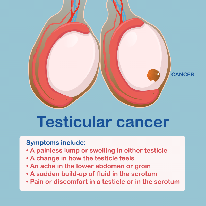 Testicular cancer