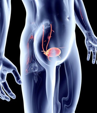 Urinary tract infections (UTIs)