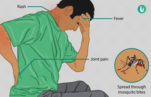 Zika virus disease